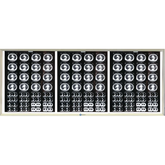 НПК Негатоскоп.Ру трехкадровый LED (светодиодный) негатоскоп<span> (Россия)</span> — МедиМакс
